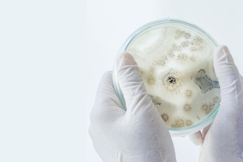 Mould Inspection by Adelaide mould expert - Assessment, sampling and lab report - 25+ years experience