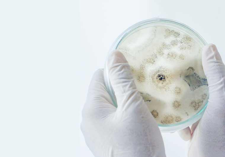 Mould Inspection by Adelaide mould expert - Assessment, sampling and lab report - 25+ years experience